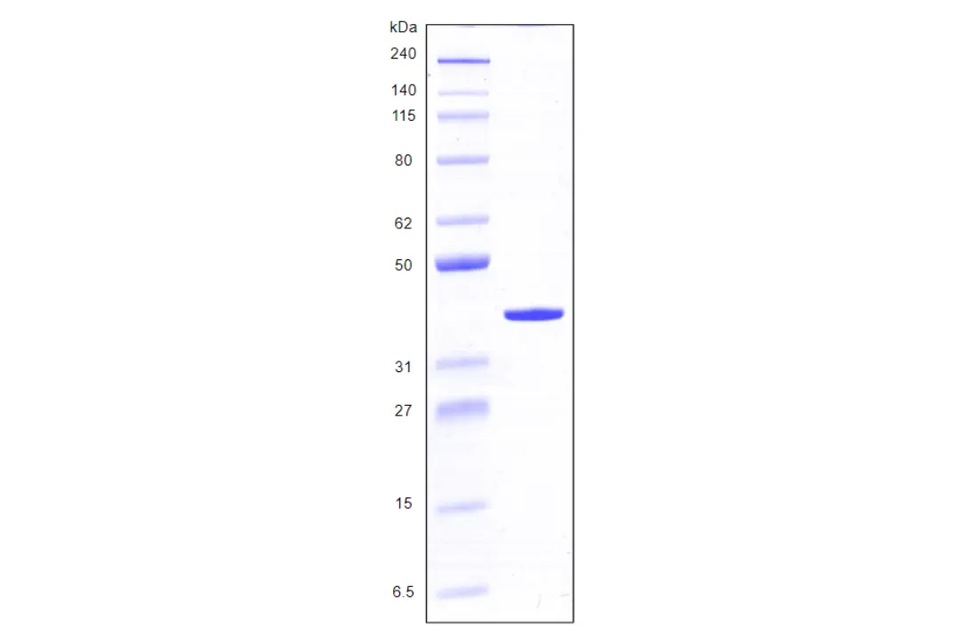 Recombinant Human Galectin 8, variant 1, His Tag (317 a.a.) -25 ug